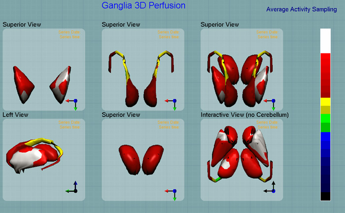 Figura 13. Figura 13.