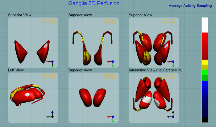 Figura 15. Figura 15.
