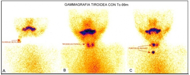 Figura 2.