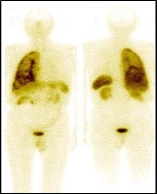 Figura 2.