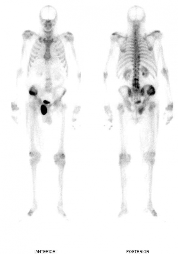 Figura 1