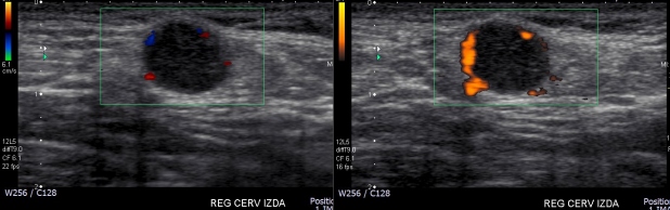 Figura 1