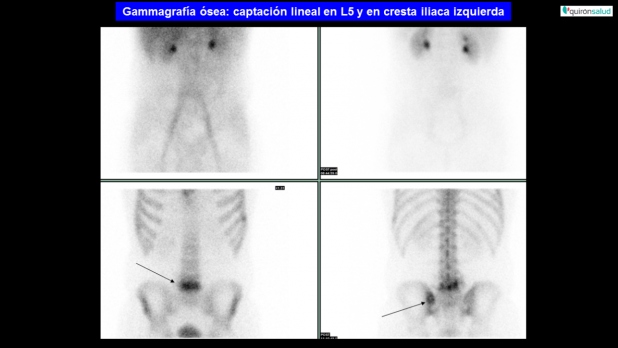 Figura 1