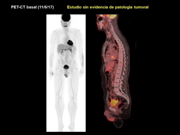 Figura 1