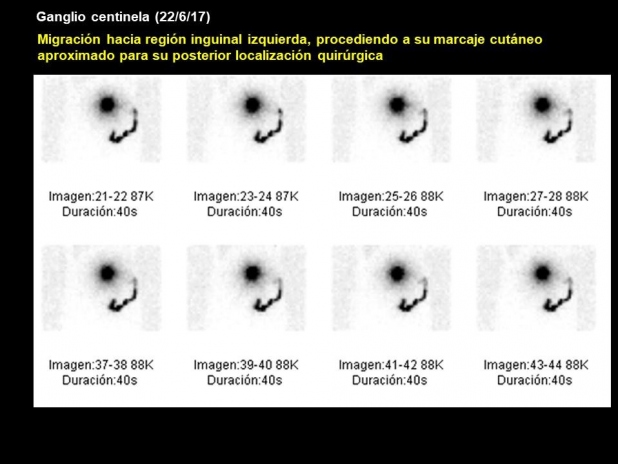 Figura 2