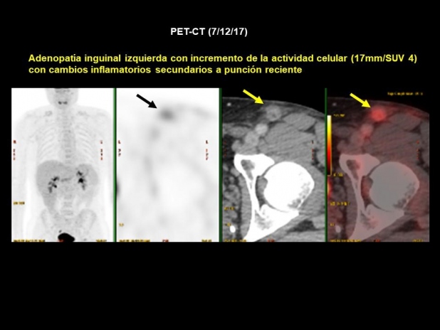 Figura 3