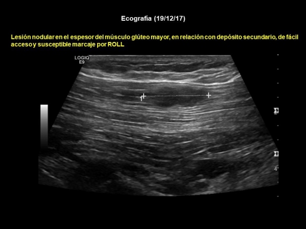Figura 5