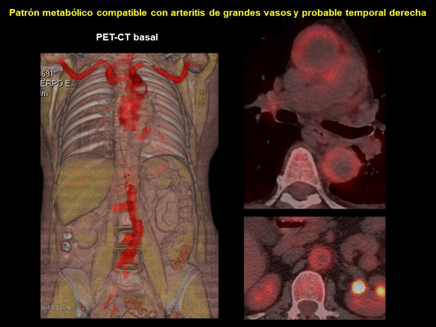 Figura 2