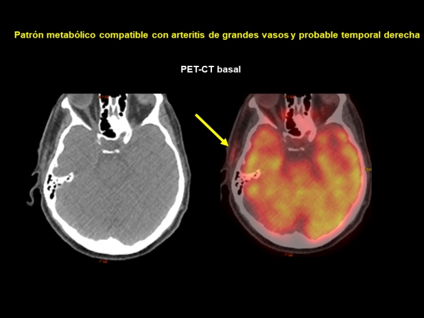 Figura 3