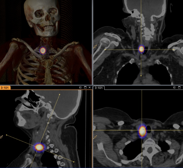 Figura 5