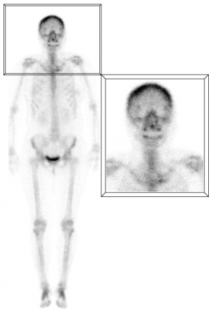 Figura 1