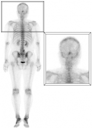 Figura 2