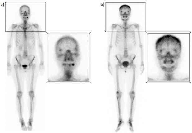 Figura 3