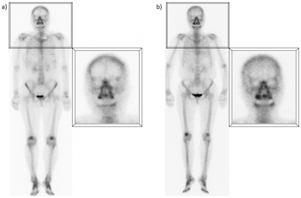 Figura 4