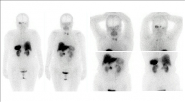 Figura 1