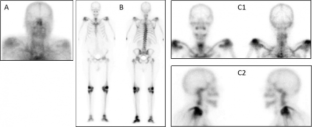 Figura 1