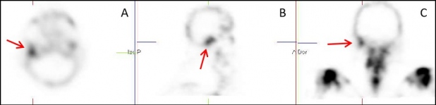 Figura 2