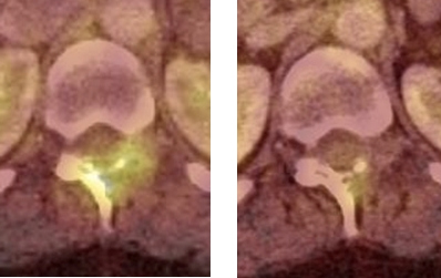 Figura 3A (izquierda).