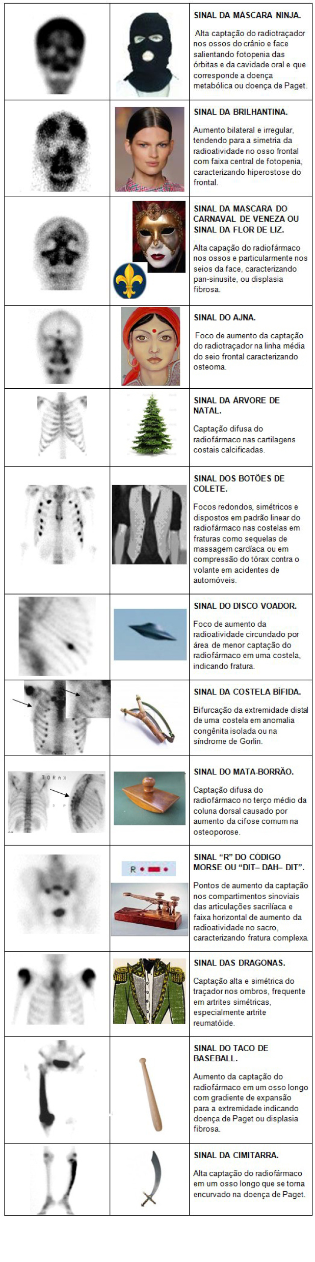 Novos sinais propostos neste trabalho