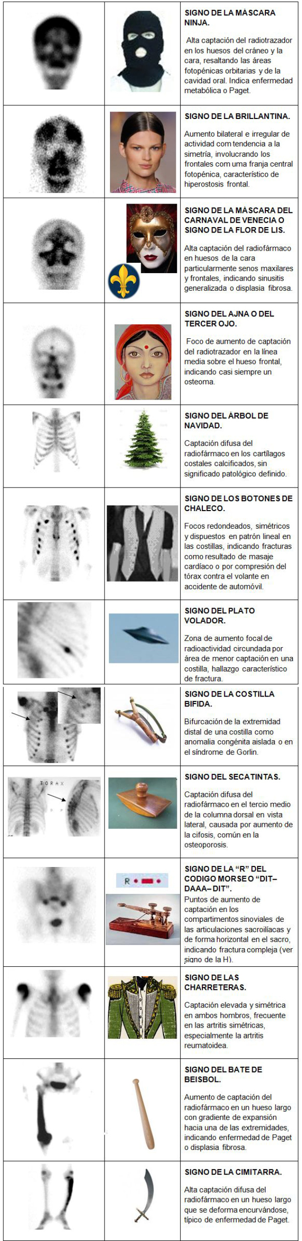 Nuevos signos propuestos en este trabajo