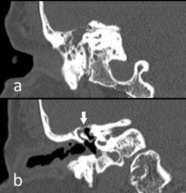 Figura 1. TC de cráneo.